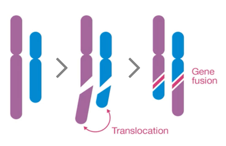 diagram showing translocation and gene fusion