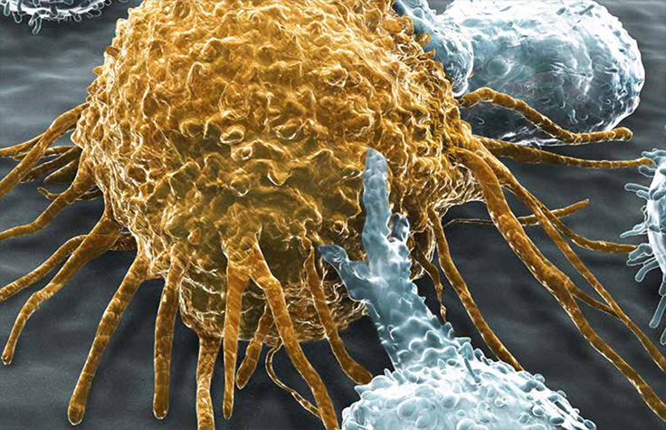 Tumor cell and immune system