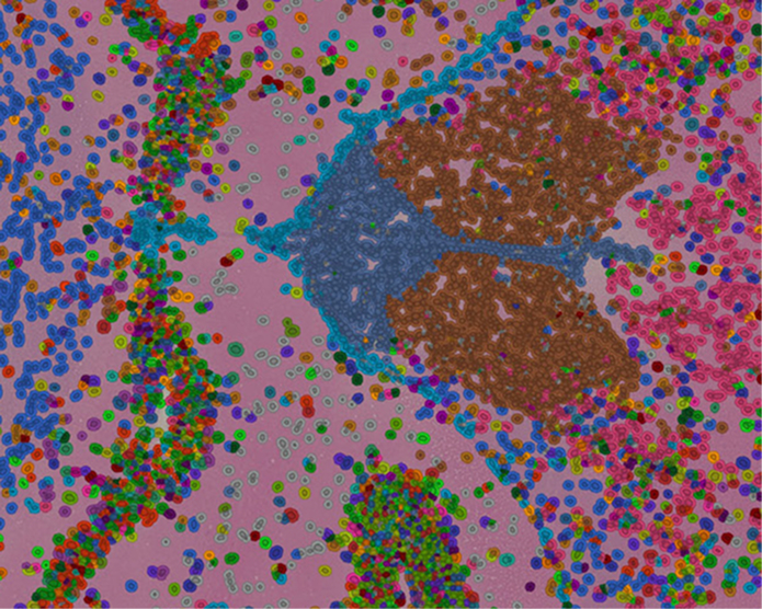 spatial transcriptomics